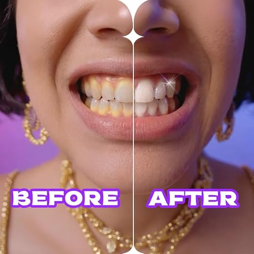 Closeup White Now Purple Color Corrector Toothpaste 100g - Image 4